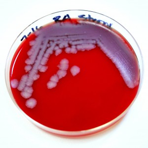 Anthrax is not known to spread from one person to another person